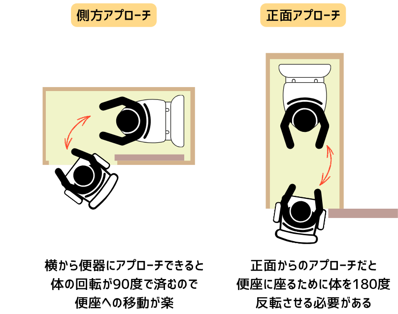 側方アプローチと正面アプローチの違い
